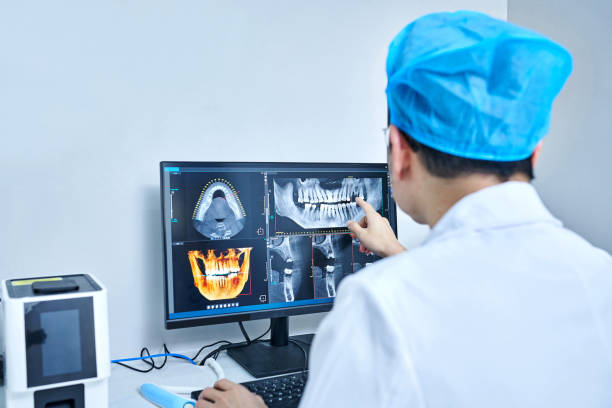 Best Knocked-Out Tooth (Avulsed Tooth) Treatment in Terrace Heights, WA
