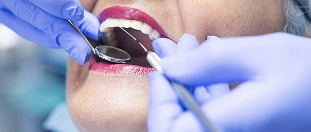 Best Emergency Wisdom Tooth Extraction in Terrace Heights, WA